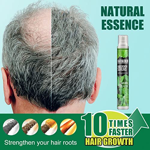 1 бр./3 бр. интензивно подхранва корените на косата, възстановява растежа на косата, билков эссенционный спрей за растежа на косата за жени и мъже